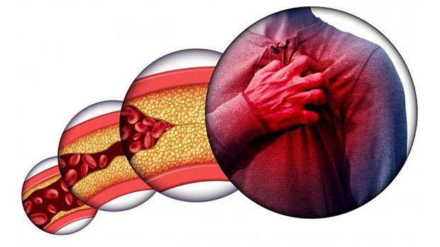 3 LOẠI THỰC PHẨM TỐT CHO NGƯỜI RỐI LOẠN MỠ MÁU